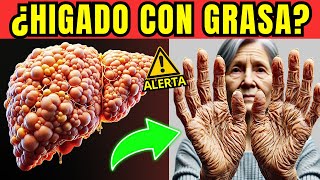 Las 5 SEÑALES de GRASA en el HÍGADO que podrían poner tu VIDA en PELIGRO [upl. by Annovy]