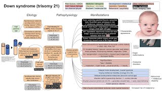 Down syndrome trisomy 21 mechanism of disease [upl. by Isidore]