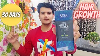 🟥 sesa hair vitaliser  sesa hair growth vitaliser use  sesa hair growth vitaliser  sesa hair oil [upl. by Levi]