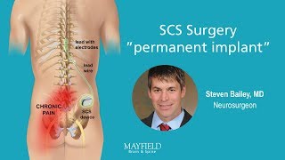 HF10 Spinal Cord Stimulation Part 2 Surgery [upl. by Assirolc]