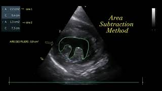 Papillary Muscle Measurements in Cat with Concentric Left Ventricular Hypertrophy [upl. by Inamik]