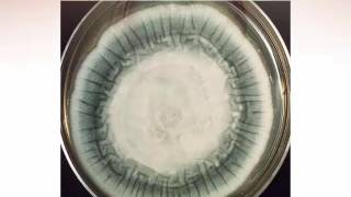 Identification of Filamentous Fungi Hyaline Monomorphic Fungi Part 5 Hot Topic [upl. by Llecrup583]