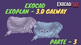 exocad  exoplan Galway 30 part 3 [upl. by Thekla]