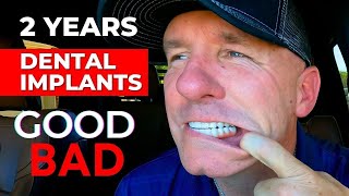 The GOOD and BAD Of My Dental Implants After 2 Years [upl. by Neehcas]