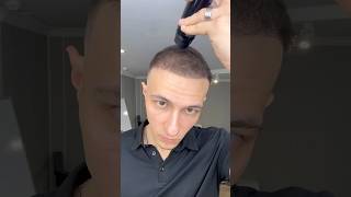 THICK FIBER  Hair Fibres for thin Hair  Hair transplant to Hair Fibers [upl. by Odnomor117]