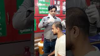 Microneedling for hair regrowth Dr aneesshaatri parkdelhi 110053 [upl. by Dimphia]