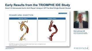 STS 2024 TRIOMPHE Study Early Results [upl. by Underwood]