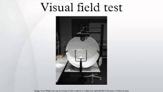 Visual field test [upl. by Netsirt]