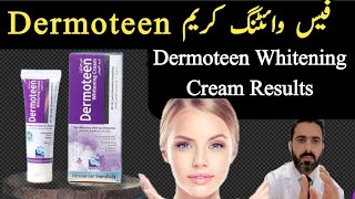 Dermoteen Whitening Cream Review Hand and Foot Whitening cream In Pakistan [upl. by Nehgaem]