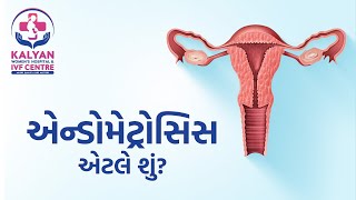 Endometriosis  High Risk Pregnancy  Pregnancy Complications  Maternity Hospital in Palanpur [upl. by Norraf]