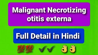 Malignant necrotizing otitis externa ent vedio with notes [upl. by Mraz]