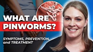 How To Treat Pinworms Symptoms Transmission Treatment amp Prevention [upl. by Ranson305]