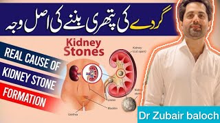 kidney Stone causes  Kidney stone Types and Preventions  Gurde ke pathri ka ilaj  गुर्दे की पथरी [upl. by Daloris]