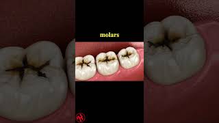 Molar teeth damaged by caries dentist healthandfitness [upl. by Weiler]