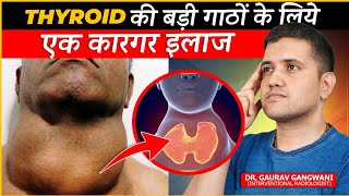 Effective Treatment For Multinodular Goitre  Thyroid Artery Embolisation  Dr Gaurav GangwaniIR [upl. by Ivanna]