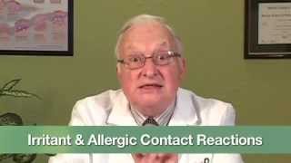 Irritant amp Allergic Contact Reactions [upl. by Bartie51]