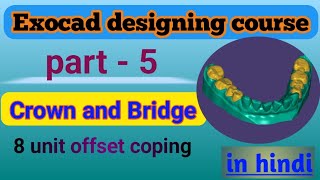 Exocad Video Tutorial Introduction to Basic Features Offset Coping Design  Offset Coping in exocad [upl. by Thielen]