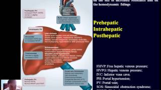 Pathophysiology of liver  part3 [upl. by Mellisa576]