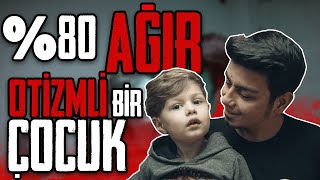 OTİZM GEÇİCİ Mİ  OTİZM EĞİTİM [upl. by Anirrok24]