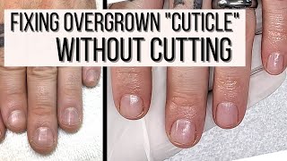 How to FIX Overgrown Cuticles WITHOUT CUTTING [upl. by Anaujd]