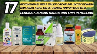 17 Rekomendasi Merek Obat Salep Cacar Air Untuk Dewasa dan Anak Agar Cepat Kering Ampuh Di Apotik [upl. by Savdeep62]