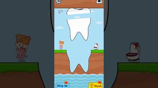 Slice this teeth🦷 to save trending viralvideo funny shorts [upl. by Ecnarrot]