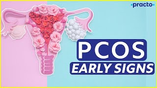 What Is PCOS  What Are The Symptoms Of PCOS  PCOS Treatment In Hindi  Practo [upl. by Swanhildas]