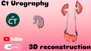 How did you make this Ct Urography 3D reconstruction  32 revolution Ct scan machine [upl. by Roydd]