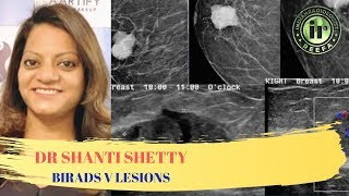 TMT BIRADS V Lesions by Dr Shanti Shetty [upl. by Yevoc91]