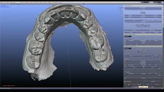 Find your bite Models are out of occlusion Let us occlude [upl. by Lenni]