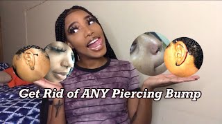 How to Get Rid of ANY KeloidPiercing bump FAST no tea tree oil JUSTTRISH [upl. by Nylazor]