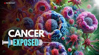 Discover the Untold Truth Behind Cancer Treatments That Could Change Everything [upl. by Serra]