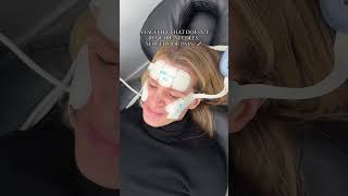 Have Your Heard of EMface the painless noninvasive facelift🤔 [upl. by Catharina]