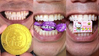 20 Minutes of Satisfying ASMR Candy and Chocolate Chewing [upl. by Ayanad]