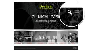 Dentium Clinical Case Server [upl. by Noelani]