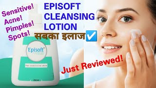 EPISOFT CLEANSING LOTION REVIEW For Sensitive SkinJust Reviewed Episoft sensitiveskin facewash [upl. by Nisa744]