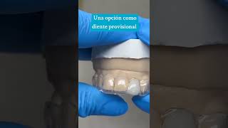 Una opción para reponer un diente fácilmente odonto dentista diente dental parati fyp foryou [upl. by Shinberg]