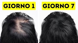 Ho Reso I Miei Capelli Più Sani E Forti In Appena Una Settimana [upl. by Siderf]