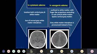 increased intracranial pressure [upl. by Broeker961]