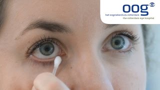 Reinigen en masseren van het ooglid bij blepharitis [upl. by Hidie410]