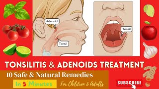 10 Best Effective Proven Home Remedies For Enlarge  Swelling ADENOIDS and TONSILS In Children [upl. by Macmullin670]