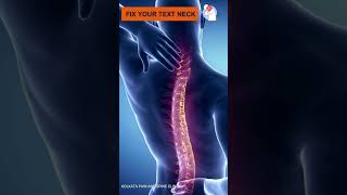 Neck Pain Text neck shorts painmanagement neckpain [upl. by Nodanrb]