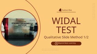 Widal Test  Qualitative Slide method  12 [upl. by Adnaerb]