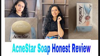 Acnestar Soap Honest Review including bloopers 😂 [upl. by Nordin]