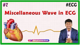 7 Miscellaneous Wave in ECG  ECG assessment and ECG interpretation made easy [upl. by Uaeb]