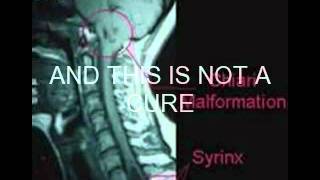 Chiari awareness video [upl. by Feltie]