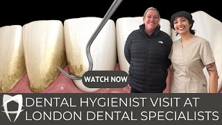 Ultimate Dental Hygienist Experience In London Dental Specialists [upl. by Ornstead929]