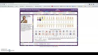 Explanation of how to use Evolve Interactive Dental Office  Digital Charting Exercises [upl. by Eiramrebma]