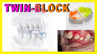 ♦️TWIN BLOCK♦️ Aparato dental para NIÑOS para corregir HIPOPLASIA MANDIBULAR [upl. by Yevol170]