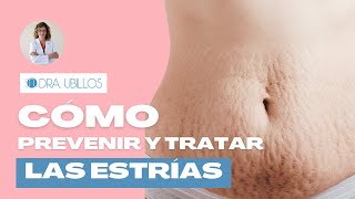 CÓMO PREVENIR Y TRATAR LAS ESTRÍAS [upl. by Anileve]